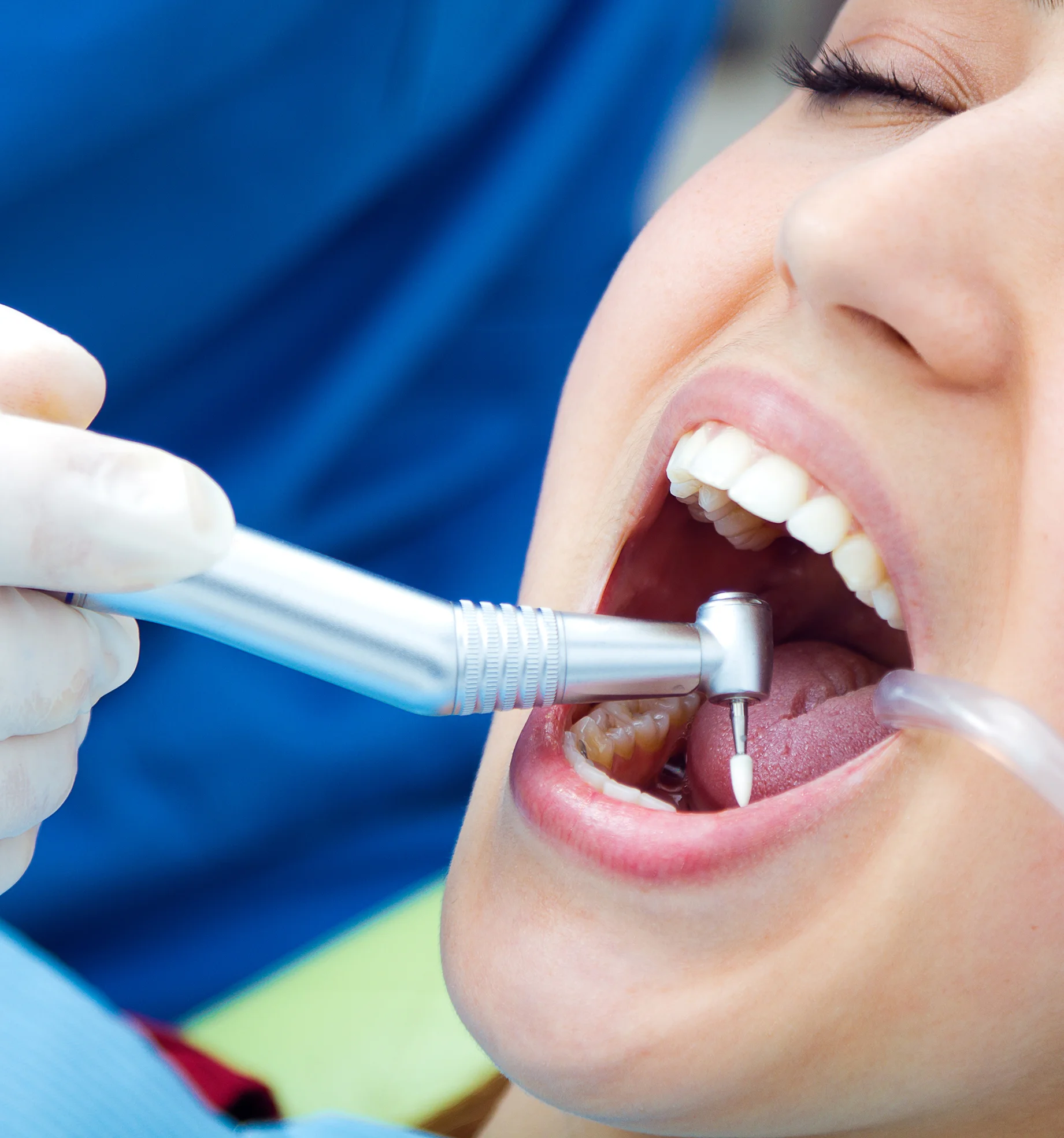 Best Root Canal Treatment in Bareilly - Gangasheel Hospital