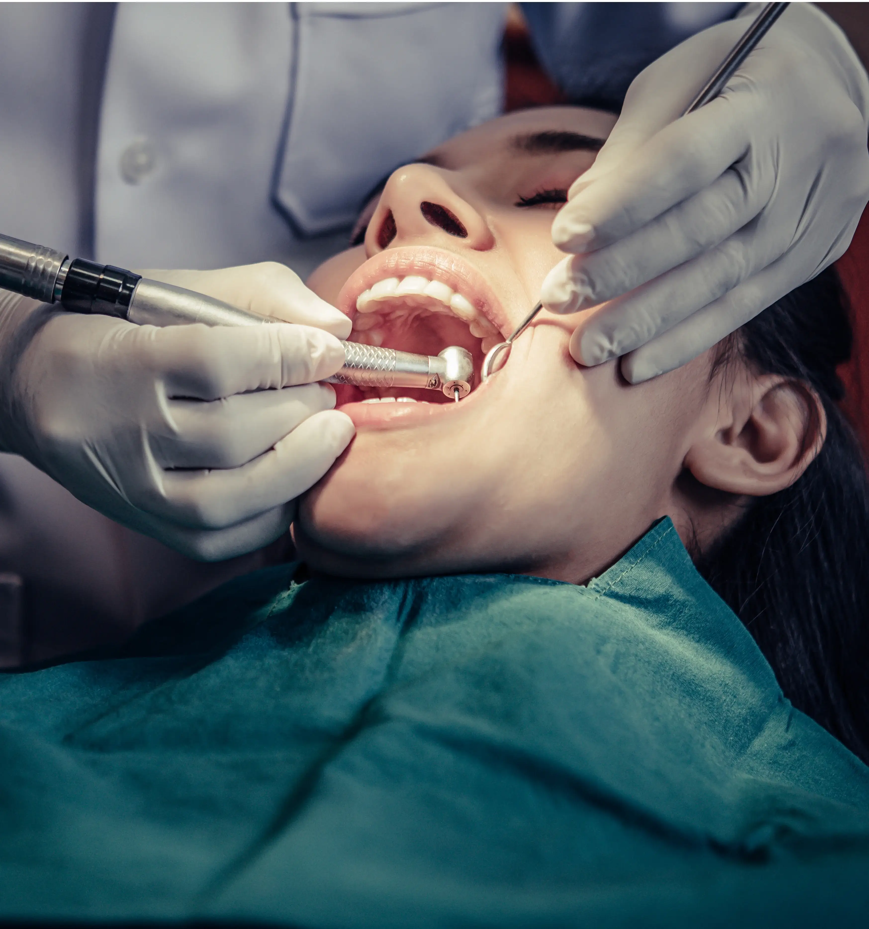 Best Treatment for Dental Fillings Surgery at Gangasheel Hospital - Bareilly