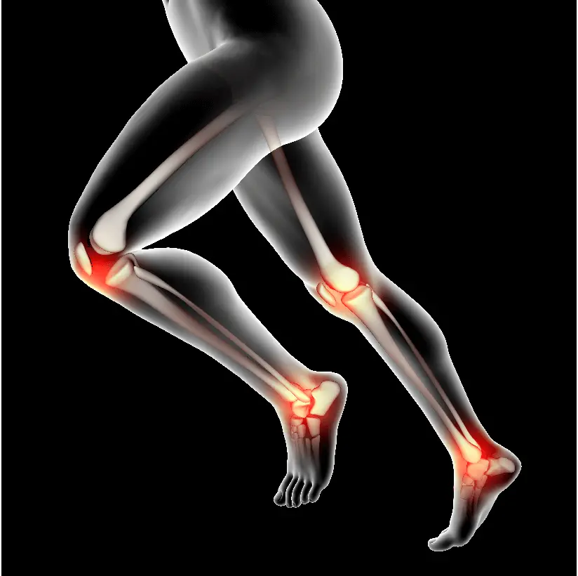 Treatment for Arthritis in Bareilly - Orthopedics Hospital