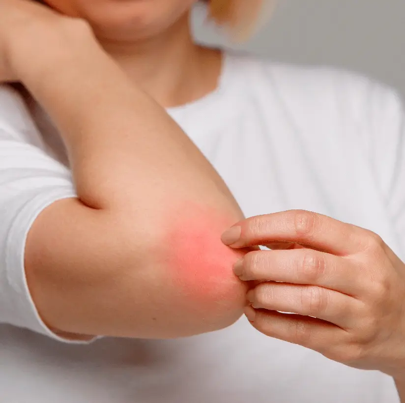 Treatment for Itching & SkinDisease in Bareilly - Gangasheel Hospital