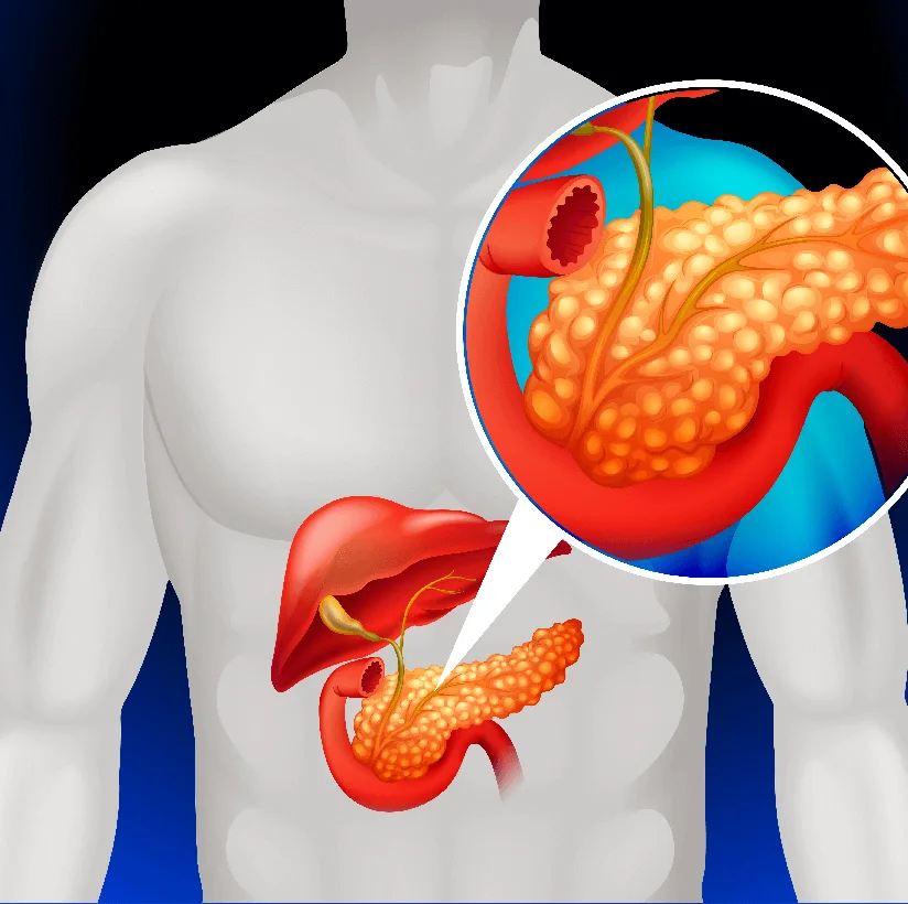 Treatment for Pancreatitis and Gastro Instestinal Diseases in Bareilly - Gangasheel Hospital